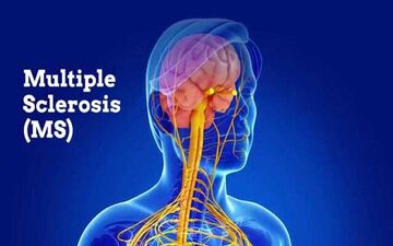 رنجی به نام "ام اس"