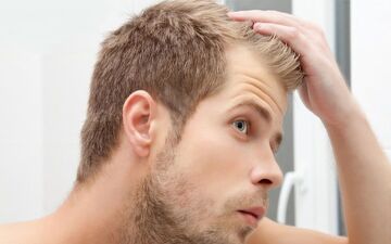 نکات مهم در رابطه با ریزش مو و روش های درمان