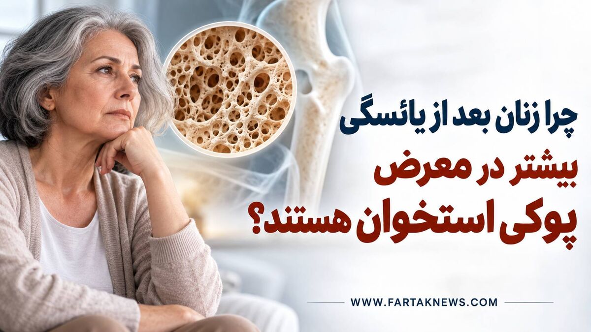 چرا زنان بعد از یائسگی بیشتر در معرض پوکی استخوان هستند؟