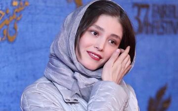 چهره "فرشته حسینی" قبل عمل زیبایی و معروفیت چه شکلی بود؟