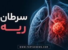 چرا سرطان ریه همچنان تهدیدی جدی برای ایرانیان است؟