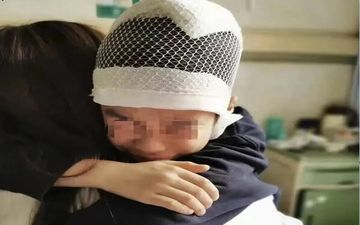 جدا شدن پوست سر و جمجمه کودک،تنبیه سخت معلم!