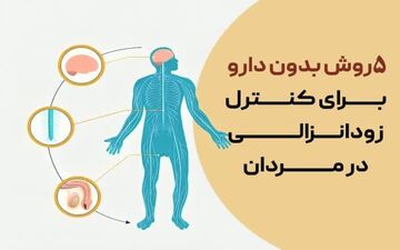 درمان زودانزالی بدون دارو | معرفی ۵ روش مؤثر و طبیعی