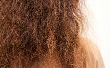 با وز مو چه کار کنیم؟ / روش های از بین بردن وز مو
