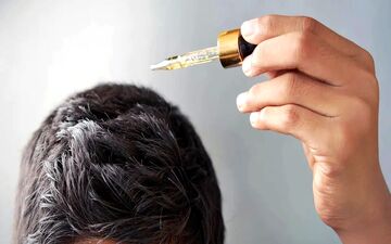ماینوکسیدیل برای ریزش مو خوب است؟

