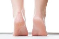 چرا نگهداری از پا در گرما اهمیت دارد؟