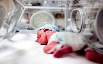 نجات یک نوزاد در قشم با وضعیت علائم حیاتی صفر در بدو تولد