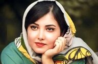 زیبا کرمعلی در ۲۸ سالگی | مقایسه چهره او با ۸ سال قبل + عکس