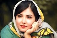 زیبا کرمعلی در ۲۸ سالگی | مقایسه چهره او با ۸ سال قبل + عکس