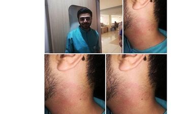 جزییات دقیق کتک خوردن پرستار شیرازی از آقای دکتر / خانم پرستار کم مانده بود بچه داخل شکمش را بیندازد! + عکس ها