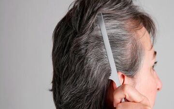  علت سفید شدن زودرس مو‌ها چیست؟