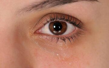 چشماهیتان را با این دلایل ماساژ ندهید