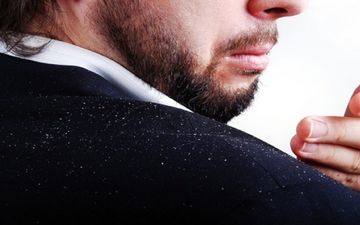  خود درمانی برای شوره سر ممنوع! 