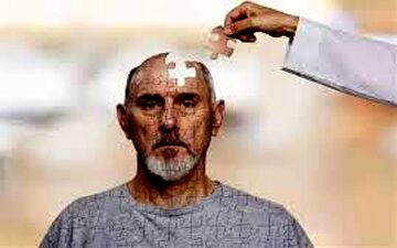 زوال عقل از اواخر ۴۰‌سالگی شروع می‌شود

