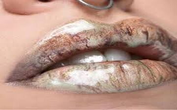  لب هایی قلوه ای و حجیم | این ادویه لب‌های شما را قلوه‌ای و حجیم می‌کند