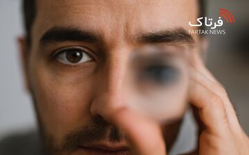 تاری دید؛ از علل ساده تا هشدارهای جدی برای سلامت چشم