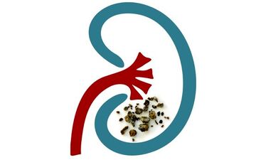 مصرف این ویتامین شما را به سنگ کلیه مبتلا می‌کند!