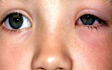 ساختمان و عملکرد چشم را بشناسید