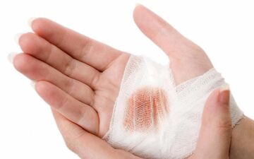 چگونه التیام زخم را سرعت ببخشیم؟