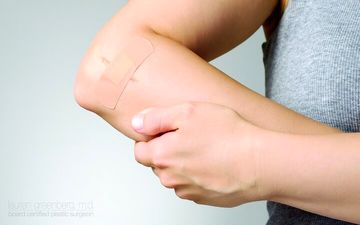 دلیل دیر خوب شدن زخم ها چیست؟

