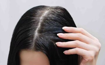 نکاتی برای جلوگیری از ریزش مو از منظر طب سنتی