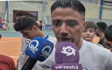 بازگشت درخشان فوق ستاره به میادین با صورت زخمی