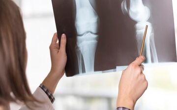 کاهش دردهای عضلانی با طب سنتی