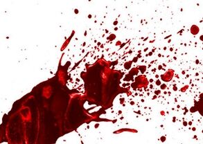 جنایت هولناک در مراسم صلح و سازش/ قتل کودک 3 ساله و والدینش به دست برادر مقتول +عکس