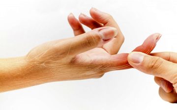 خم شدن انگشت دست چه دلیلی دارد؟