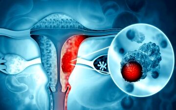 علایم شایع سومین سرطان شایع زنان چیست؟ | بهترین سن برای تزریق واکسن HPV برای زنان |آیا مردان هم می‌توانند واکسن HPV بزنند؟
