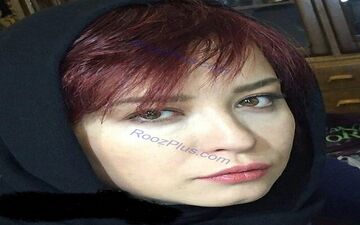 تغییر چهره بازیگر زن مشهور+ عکس