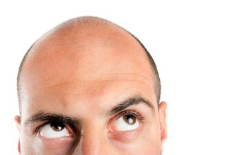 برای مقابله با ریزش مو،راهی وجود دارد؟ 