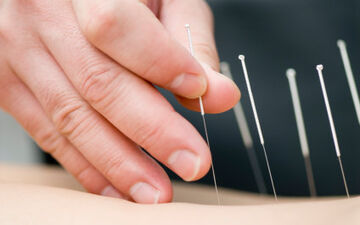 "طب سوزنی" و "نخ درمانی" در درمان چه بیماری‌هایی موثرند؟