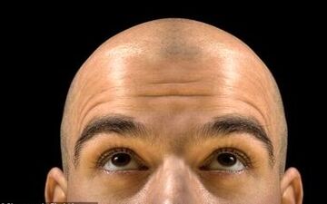 دستور ساخت یک ترکیب گیاهی ساده برای جلوگیری از "ریزش مو"