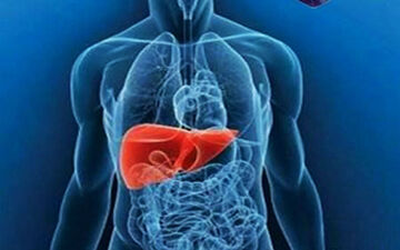 پیشگیری از یک بیماری خطرناک با چند روش ساده+فیلم