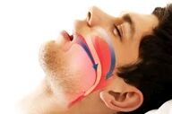 در مورد آپنه خواب چه میدانید؟