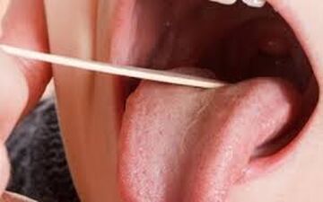 بزاق دهانتان چه چیزی را آشکار میکند؟
