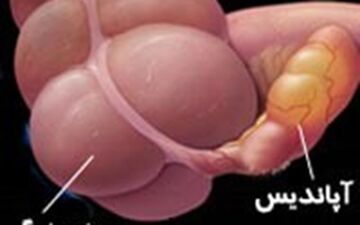هشدار: شایع‌ترین جراحی کودکان غیرضروری است