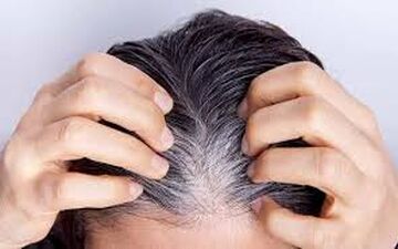 چکار کنیم از سفید شدن مو جلوگیری کنیم؟
