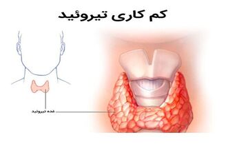 تاثیر رژیم غذایی در سلامت تیروئید 