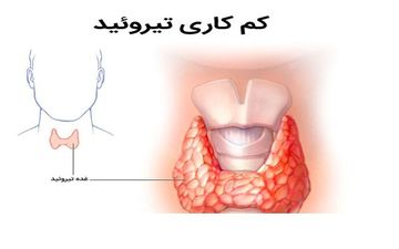 تاثیر رژیم غذایی در سلامت تیروئید 