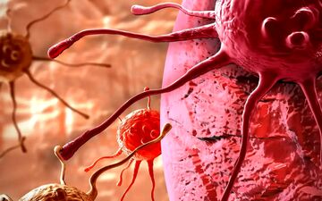 چگونه با تغییرات کوچک در سبک زندگی، خطر ابتلا به سرطان را کاهش دهیم؟