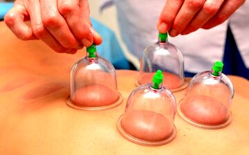 بدترین زمان‌ها برای حجامت چه زمانی است؟
