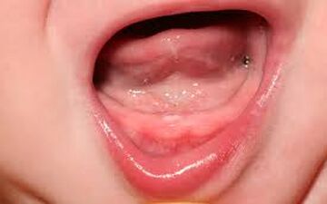 چگونه از دندان‌های نوزاد نگهداری کنیم؟