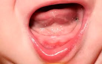 چگونه از دندان‌های نوزاد نگهداری کنیم؟