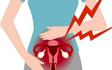 بعد از هیسترکتومی چه زمانی می‌توان رابطه جنسی داشت؟