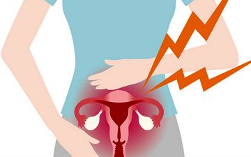 بعد از هیسترکتومی چه زمانی می‌توان رابطه جنسی داشت؟