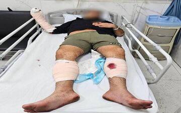 پایان قدرت‌نمایی شرور سابقه‌دار در تهران؛ متهم با شلیک پلیس زمین‌گیر شد