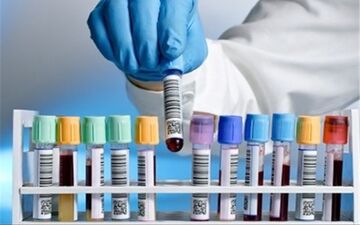 توانایی ایران درتأمین کامل داروی فاکتور9 از پلاسمای داخلی
