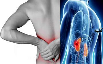 خداحافظی با یک نوع سرطان شایع

